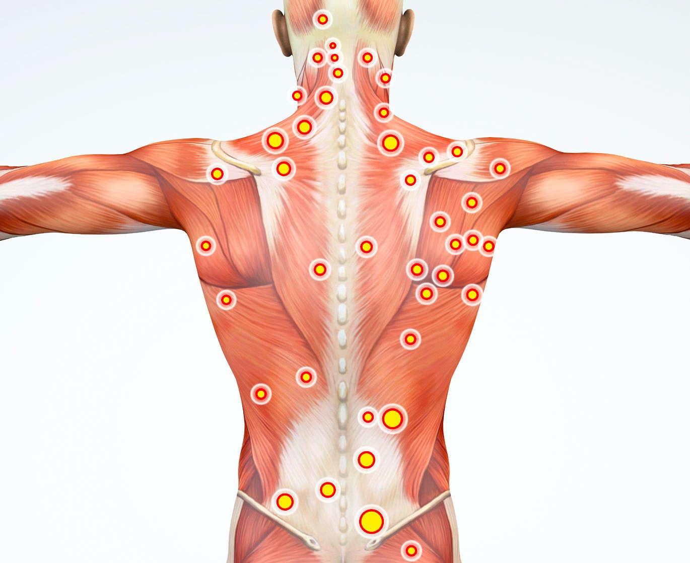 49098-myofascial_pain_syndrome_trigger_points_99450800_ml_cropped